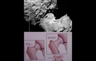 Ancient Texts of Every Culture Claimed the Universe is Body Parts Like This Hip Joint Called 67P