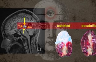 I finally decalcified my pineal gland! Here’s how