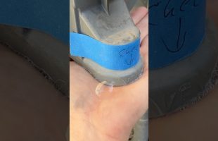 Why has this become so common?
