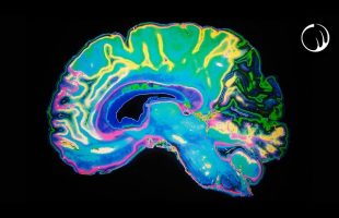One of the Most Unsettling Phenomena of the Human Brain