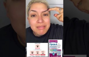 P1 Follow @drsarahavila #beautyhacks #shorts #shortvideo