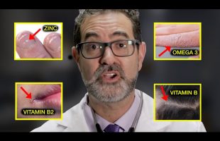 “You May Not Be Healthy Even If You Think You Are” (9 signs)