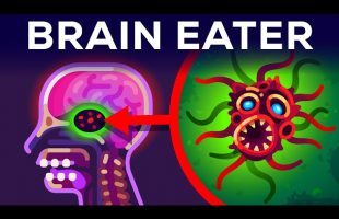 The Most Horrible Parasite: Brain Eating Amoeba