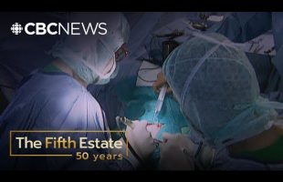 A medical patch taken from corpses led to a brain disease | The Fifth Estate (2002)