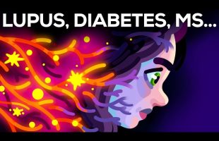 When Your Body Attacks Itself – Autoimmune