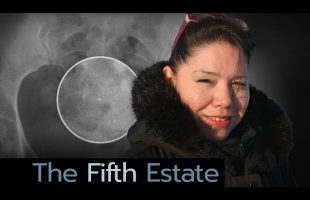 No more tears: The Essure legacy