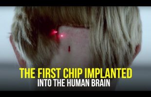 “This Could Be a Tragedy For Humanity” | The First Brain Chip Implant