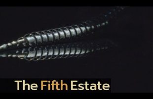 Unreported: The Essure Story | Implant Files