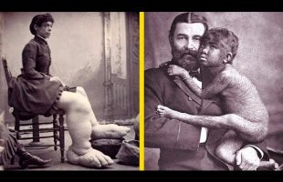 A Brief “Dark” History Of Freak Shows