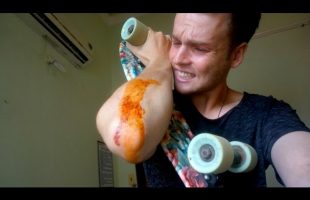 BAD SKATEBOARD FALL – VIETNAM TRAVEL