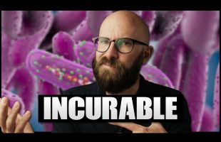 Marburg: The Completely Untreatable Virus