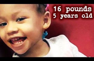 16 Pounds At 5 Years Old: The Sickening Case of Cali Anderson